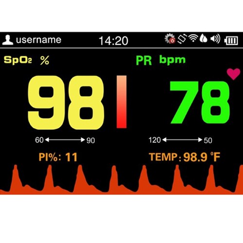 Handheld Pulse Oximeter Adult SP-20