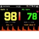 Handheld Pulse Oximeter Adult SP-20