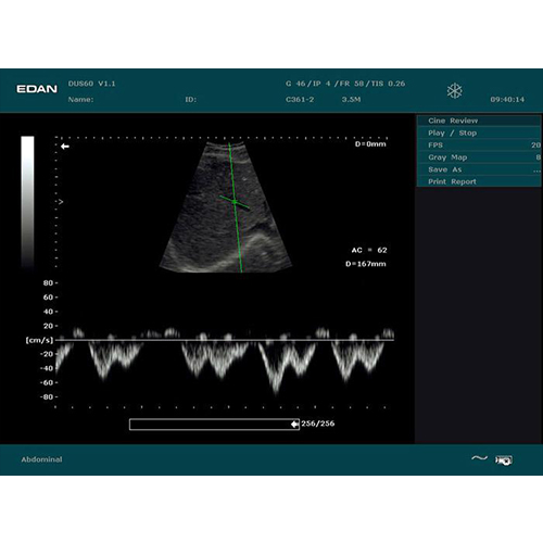 جهاز سونار ايدان التراساوند DUS 60 جهاز سونار ايدان التراساوند DUS 60